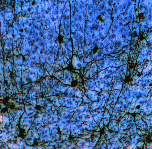  Neuroni corticali - BM&L collection 