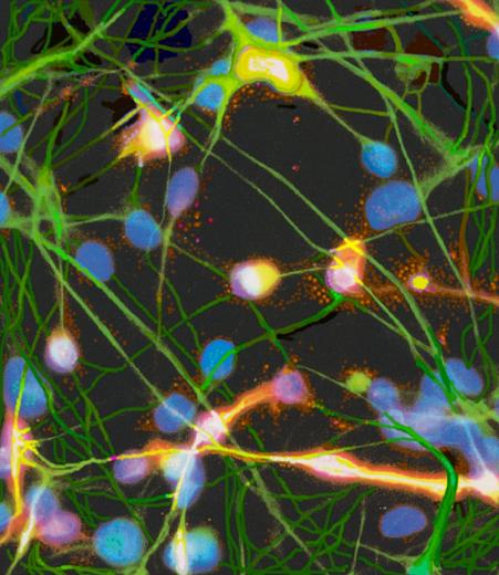 Neurons from ES cells - BM&L collection